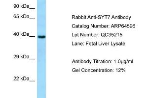 Western Blotting (WB) image for anti-Synaptotagmin VII (SYT7) (N-Term) antibody (ABIN2774402) (SYT7 antibody  (N-Term))