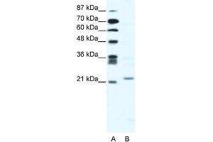 WB Suggested Anti-TWIST1 Antibody Titration:  2. (TWIST1 antibody  (C-Term))