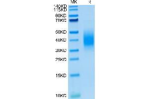 Mouse BTLA on Tris-Bis PAGE under reduced condition. (BTLA Protein (AA 30-176) (His tag))