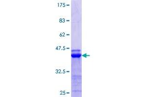 ATF6B Protein (AA 2-88) (GST tag)