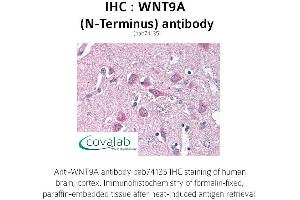 Image no. 1 for anti-Wingless-Type MMTV Integration Site Family, Member 9A (WNT9A) (N-Term) antibody (ABIN1740844) (WNT9A antibody  (N-Term))