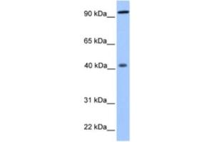 Western Blotting (WB) image for anti-Pygopus Homolog 1 (Drosophila) (PYGO1) antibody (ABIN2463350)
