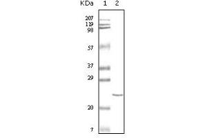 Western blot analysis using cTnI mouse mAb against truncated cTnI recombinant protein. (TNNI3 antibody)
