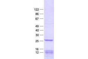 Validation with Western Blot (PLSCR2 Protein (His tag))