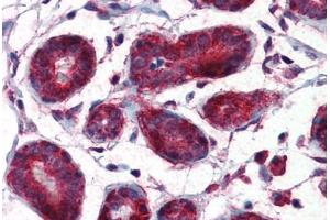 Human Breast (formalin-fixed, paraffin-embedded) stained with MIF antibody ABIN364319 at 5 ug/ml followed by biotinylated anti-mouse IgG secondary antibody ABIN481714, alkaline phosphatase-streptavidin and chromogen. (MIF antibody  (AA 1-114))