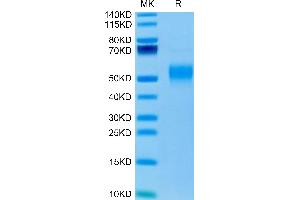 Mouse Fc gamma RI/CD64 on Tris-Bis PAGE under reduced condition. (FCGR1 Protein (AA 25-297) (His tag))