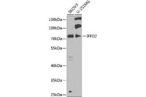 Western blot analysis of extracts of various cell lines, using IFFO2 antibody (ABIN6133429, ABIN6142160, ABIN6142161 and ABIN6223442) at 1:1000 dilution. (IFFO2 antibody)