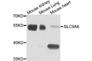 Western blot analysis of extract of various cells, using SLC9A6 antibody.