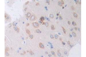 Figure. (IL-4 antibody  (AA 61-111))