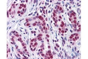 Anti-HuR antibody IHC of human breast. (ELAVL1 antibody  (AA 1-101))