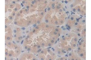 Immunohistochemistry (IHC) image for anti-SHC (Src Homology 2 Domain Containing) Transforming Protein 3 (SHC3) (AA 188-433) antibody (ABIN7443536)