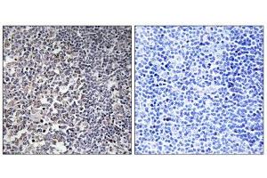 Immunohistochemistry analysis of paraffin-embedded human tonsil tissue using MRPS16 antibody. (MRPS16 antibody  (Internal Region))