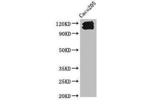 Western Blot Positive WB detected in: Caco205 whole cell lysate All lanes: CDH1 antibody at 1:1000 Secondary Goat polyclonal to Mouse IgG at 1/10000 dilution Predicted band size: 98, 91 kDa Observed band size: 110, 120 kDa (E-cadherin antibody  (AA 155-707))