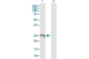 Western Blot analysis of HSD17B10 expression in transfected 293T cell line by HSD17B10 MaxPab polyclonal antibody. (HSD17B10 antibody  (AA 1-261))