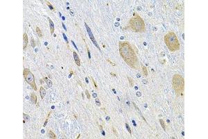 Immunohistochemistry of paraffin-embedded Mouse brain using LGR6 Polyclonal Antibody at dilution of 1:100 (40x lens). (LGR6 antibody)