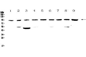Western blot analysis of Cullin 5 using anti-Cullin 5 antibody .