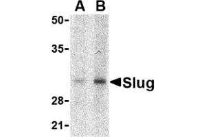 Western Blotting (WB) image for anti-SLUG (Middle Region 1) antibody (ABIN1031191) (SLUG antibody  (Middle Region 1))