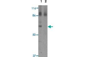 Western blot analysis of RBM35A in rat colon tissue lysate with RBM35A polyclonal antibody  at 0.