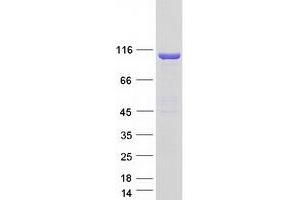 Validation with Western Blot