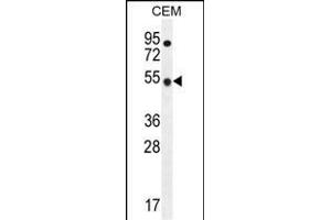 TBC1D13 Antibody (Center) (ABIN655819 and ABIN2845243) western blot analysis in CEM cell line lysates (35 μg/lane). (TBC1D13 antibody  (AA 76-105))