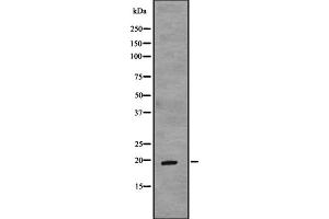 Western blot analysis of TCAP expression in Fetal muscle lysate Fetal heart lysate,The lane on the left is treated with the antigen-specific peptide. (TCAP antibody  (N-Term))