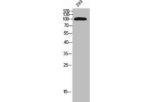 Western Blot analysis of 293 cells using KIF20A Polyclonal Antibody (KIF2A antibody)