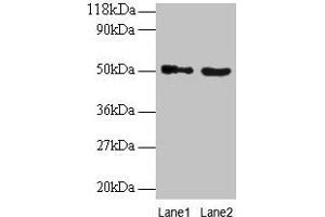 Western blot All lanes: VOPP1 antibody at 2 μg/mL Lane 1: EC109 whole cell lysate Lane 2: 293T whole cell lysate Secondary Goat polyclonal to rabbit IgG at 1/15000 dilution Predicted band size: 20, 19, 18 kDa Observed band size: 50 kDa