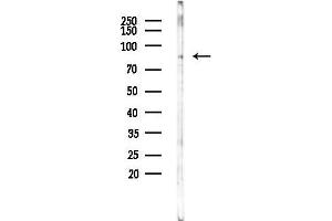 Western blot analysis of lysates from F10-LUC cells(starvation 24h treatment), using EWSR1 Antibody at 1/1000 dilution.