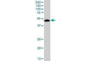 VDR MaxPab polyclonal antibody. (Vitamin D Receptor antibody  (AA 1-427))