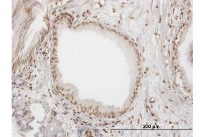 Immunoperoxidase of monoclonal antibody to IFI16 on formalin-fixed paraffin-embedded human prostate. (IFI16 antibody  (AA 630-729))