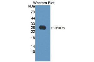 Western blot analysis of the recombinant protein. (VEGFB antibody  (AA 21-207))