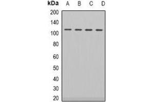 Western blot analysis of Androgen Receptor expression in HEK293T (A), LOVO (B), NIH3T3 (C), PC12 (D) whole cell lysates. (Androgen Receptor antibody)