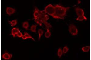 ABIN6274805 staining Hela by IF/ICC. (ACOT2 antibody  (Internal Region))