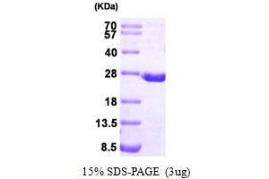 Dihydrofolate Reductase Protein (DHFR) (AA 1-187) (His tag)