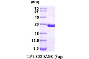 SDS-PAGE (SDS) image for Dihydrofolate Reductase (DHFR) (AA 1-187) protein (His tag) (ABIN666887)
