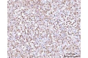 IHC analysis of RNGTT using anti-RNGTT antibody (ABIN7599723). (RNGTT antibody  (AA 11-438))