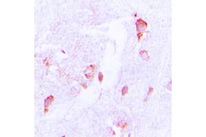 Immunohistochemical analysis of CSRNP2 staining in human brain formalin fixed paraffin embedded tissue section. (CSRNP2 antibody  (Center))