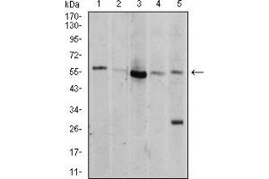 Western Blotting (WB) image for anti-V-Akt Murine Thymoma Viral Oncogene Homolog 1 (AKT1) (AA 1-150) antibody (ABIN5856183) (AKT1 antibody  (AA 1-150))