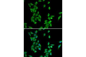 Immunofluorescence analysis of HeLa cells using ANXA4 antibody (ABIN6290015).