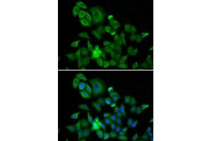 Immunofluorescence analysis of A549 cell using HMMR antibody. (HMMR antibody  (AA 341-440))