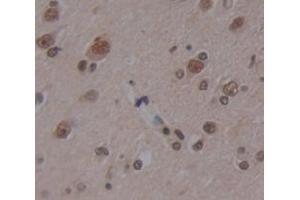 Figure. (Titin antibody  (AA 33779-34025))