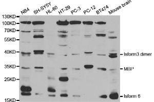 Western blot analysis of extracts of various cell lines, using MBP antibody. (MBP antibody)
