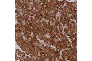 Immunohistochemical staining of human pancreas with ARHGEF10L polyclonal antibody  shows strong cytoplasmic positivity in exocrine cells at 1:10-1:20 dilution. (ARHGEF10L antibody)