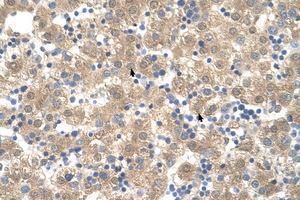 Image no. 1 for anti-Cyclophilin B (PPIB) (C-Term) antibody (ABIN205044) (PPIB antibody  (C-Term))