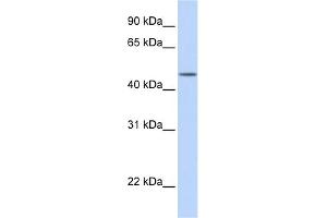 WB Suggested Anti-TBL2 Antibody Titration: 0.