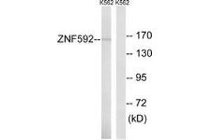 Western blot analysis of extracts from K562 cells, using ZNF592 Antibody. (ZNF592 antibody  (AA 961-1010))