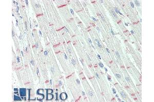 Immunohistochemistry (IHC) image for anti-G Protein-Coupled Receptor 17 (GPR17) (C-Term) antibody (ABIN571066)