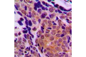 Immunohistochemistry (IHC) image for anti-T-Complex 1 (TCP1) (C-Term) antibody (ABIN7297418)
