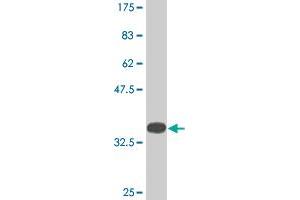 Western Blot detection against Immunogen (35. (KDM5B antibody  (AA 231-319))
