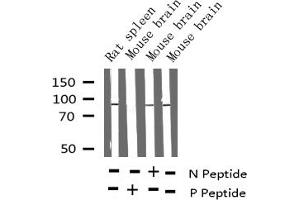 Western blot analysis of Phospho-PKC-pan (Thr497) expression in various lysates (PKC antibody  (pThr497))
